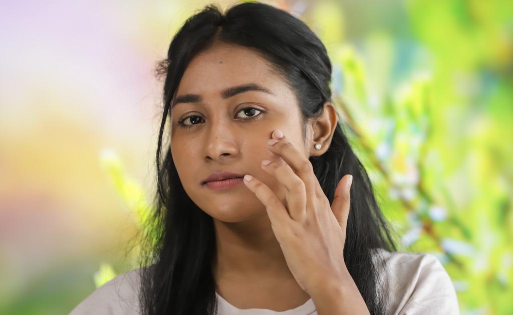 ব্রণে হাত চলে যাচ্ছে বারবার? ৬টি উপায়ে দূর করুন এই অভ্যাস!