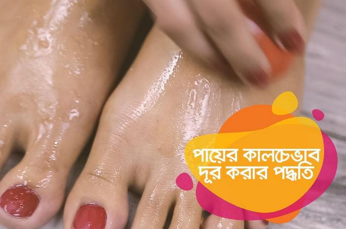 পায়ের কালচে ভাব দূর করার পদ্ধতি