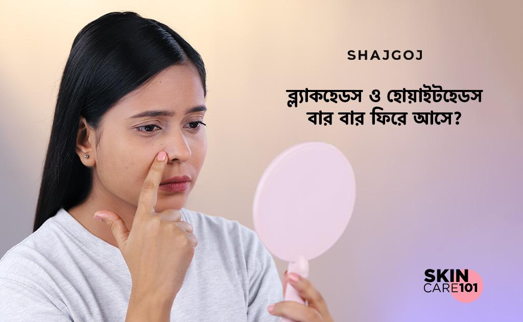 ব্ল্যাকহেডস ও হোয়াইটহেডস বার বার ফিরে আসে?