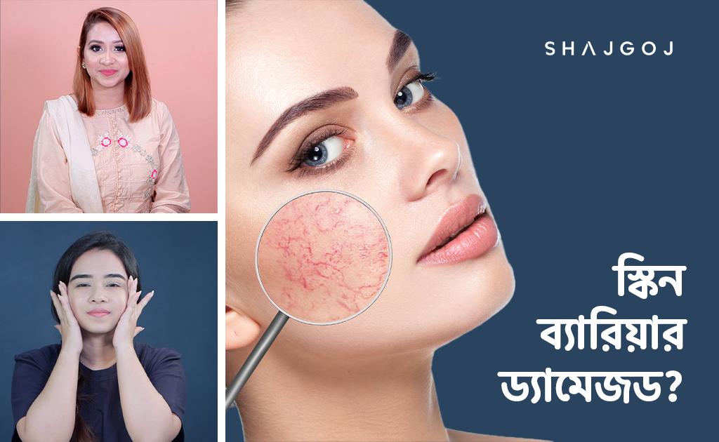 স্কিন ব্যারিয়ার ড্যামেজড?