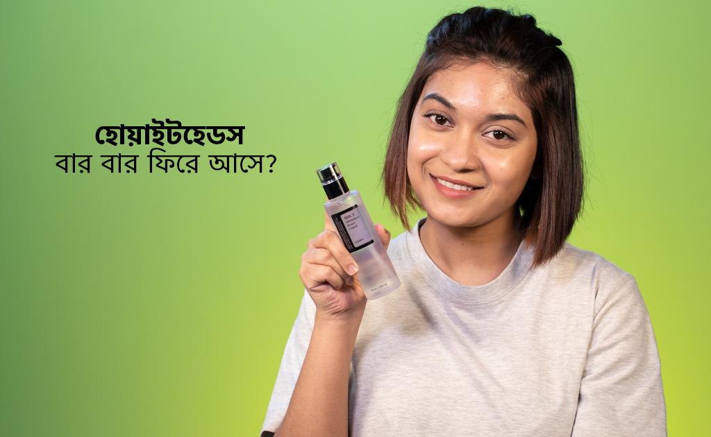 হোয়াইটহেডস বার বার ফিরে আসে?